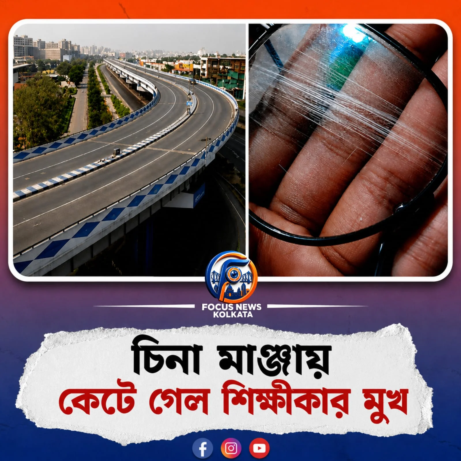 মা ফ্লাইওভারে চিনা মাঞ্জার আতঙ্ক: গুরুতর জখম শিক্ষিকা